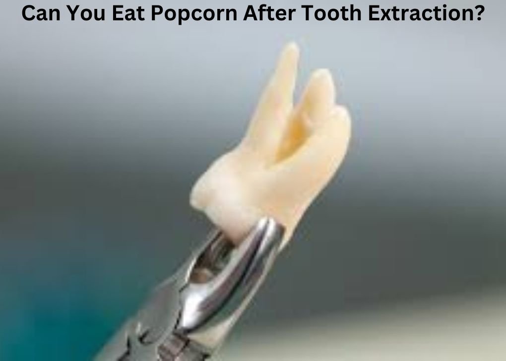 Can You Eat Popcorn After Tooth Extraction?